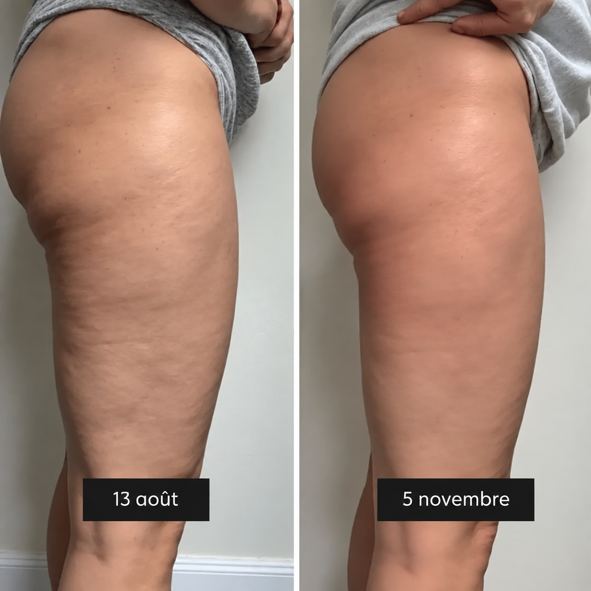 Yveria – Legging Anti-Cellulite 3D, Résultats Visibles Dès le Premier Port