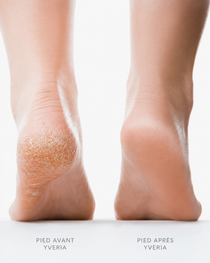 Yveria – Ponceuse Électrique Pieds, Fini les Callosités