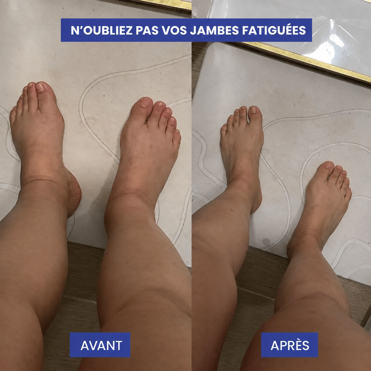 Yveria – Chaussettes de Compression, Jambes Légères