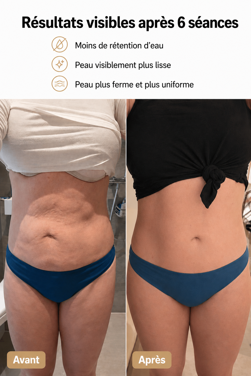 Yveria — Masseur Anti-Cellulite pour une Peau Lisse et Ferme en 14 Jours