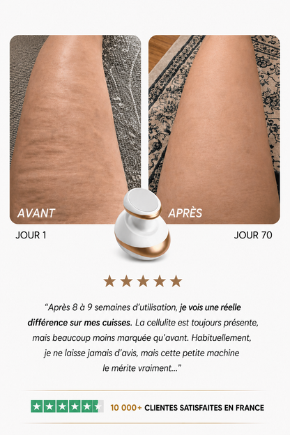 Yveria — Masseur Anti-Cellulite pour une Peau Lisse et Ferme en 14 Jours