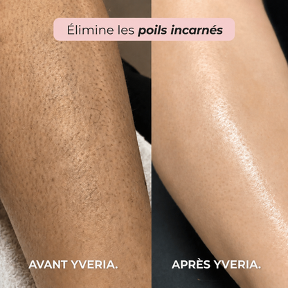 Yveria — Le Rasoir 2 en 1 Sans Coupures ni Irritations