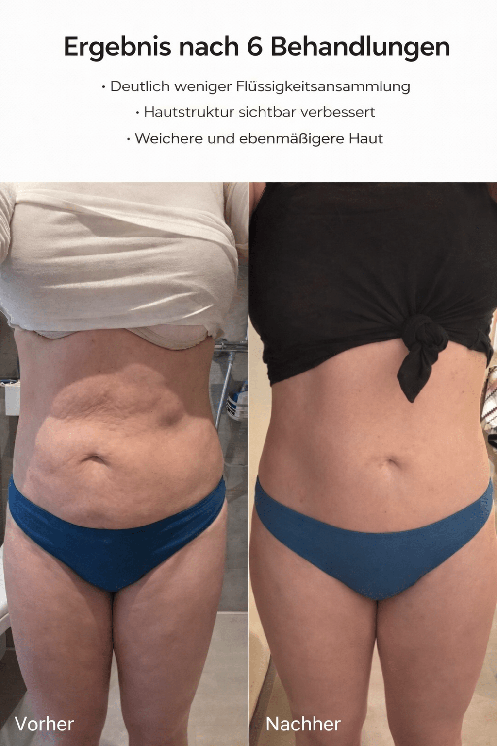 Celluviaa – glatte Haut in 14 Tagen